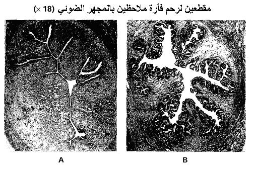 اضغط على الصورة لرؤيتها بالحجم الطبيعي