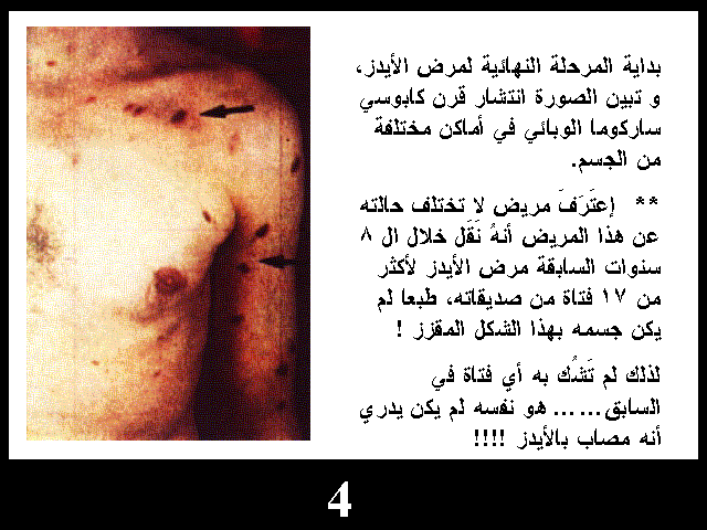 البرونزية