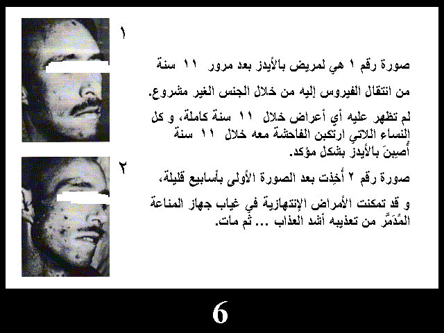 البرونزية